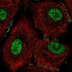 Invitrogen OVCA1 Polyclonal Antibody 100 &mu;L; Unconjugated:Antibodies,