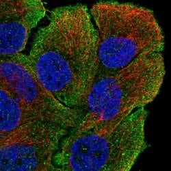 Invitrogen MYO5B Polyclonal Antibody 100 &mu;L; Unconjugated:Antibodies,