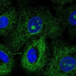 Invitrogen MTUS1 Polyclonal Antibody 100 &mu;L; Unconjugated:Antibodies,