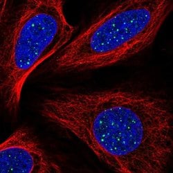 Invitrogen TIN2 Polyclonal Antibody 100 &mu;L; Unconjugated:Antibodies,