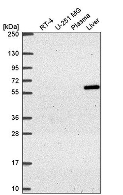 Invitrogen TIN2 Polyclonal Antibody 100 &mu;L; Unconjugated:Antibodies,