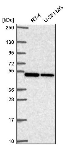 Invitrogen CNOT11 Polyclonal Antibody 100 &mu;L; Unconjugated:Antibodies,