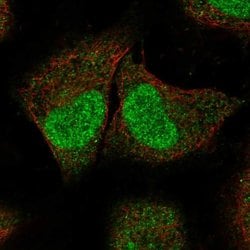 Invitrogen SPIN2A Polyclonal Antibody 100 &mu;L; Unconjugated:Antibodies,