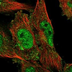 SACM1L Polyclonal Antibody:Antibodies, Polyclonal
