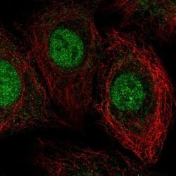 Invitrogen THAP8 Polyclonal Antibody 100 &mu;L | Buy Online | Invitrogen&trade; | Fisher Scientific