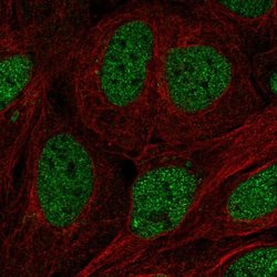 Invitrogen TFCP2 Polyclonal Antibody 100 &mu;L; Unconjugated:Antibodies,