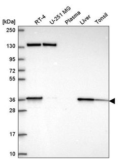 Invitrogen SC5D Polyclonal Antibody 100 &mu;L; Unconjugated:Antibodies,