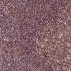 Invitrogen MDP1 Polyclonal Antibody 100 &mu;L; Unconjugated:Antibodies,