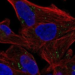 Invitrogen SLA/LP Polyclonal Antibody 100 &mu;L; Unconjugated:Antibodies,