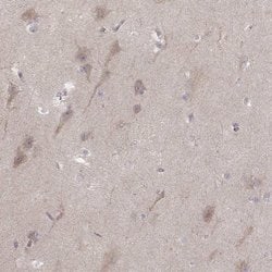 Invitrogen Kir3.3 (KCNJ9) Polyclonal Antibody 100 &mu;L; Unconjugated:Antibodies,