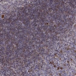 Invitrogen Cyclin F Polyclonal Antibody 100 &mu;L | Buy Online | Invitrogen&trade; | Fisher Scientific