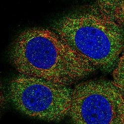 Invitrogen LPIN3 Polyclonal Antibody 100 &mu;L; Unconjugated:Antibodies,