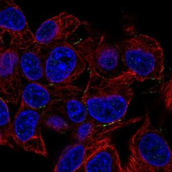 PKP4 Polyclonal Antibody:Antibodies, Polyclonal