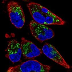 Invitrogen TMEM71 Polyclonal Antibody 100 &mu;L; Unconjugated:Antibodies,
