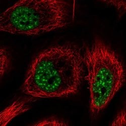 Invitrogen RBM25 Polyclonal Antibody 100 &mu;L; Unconjugated:Antibodies,
