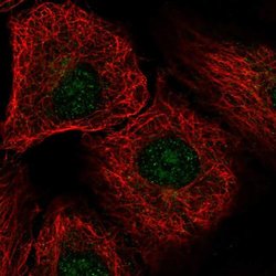 DDX54 Polyclonal Antibody:Antibodies, Polyclonal