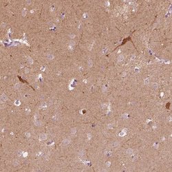 Invitrogen GPRIN1 Polyclonal Antibody 100 &mu;L; Unconjugated:Antibodies,