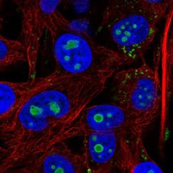 Invitrogen ACSL3 Polyclonal Antibody 100 &mu;L; Unconjugated:Antibodies,