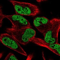 Invitrogen CCM2L Polyclonal Antibody 100 &mu;L; Unconjugated:Antibodies,