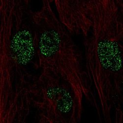 Invitrogen FICD Polyclonal Antibody 100 &mu;L; Unconjugated:Antibodies,