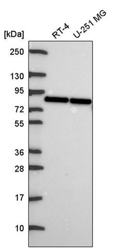 Invitrogen OATP1 Polyclonal Antibody 100 &mu;L; Unconjugated:Antibodies,