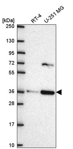 Invitrogen SCAMP3 Polyclonal Antibody 100 &mu;L; Unconjugated:Antibodies,