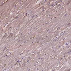 Invitrogen CRYBA4 Polyclonal Antibody 100 &mu;L; Unconjugated:Antibodies,