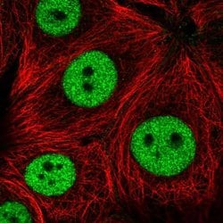 Invitrogen ZNF335 Polyclonal Antibody 100 &mu;L; Unconjugated:Antibodies,