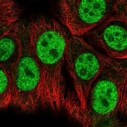 Invitrogen RBAK Polyclonal Antibody 100 &mu;L; Unconjugated:Antibodies,