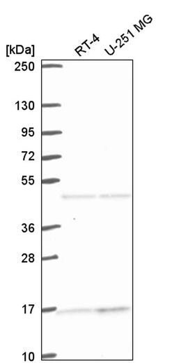 Invitrogen ACTR10 Polyclonal Antibody 100 &mu;L; Unconjugated:Antibodies,