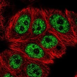 Invitrogen RCL1 Polyclonal Antibody 100 &mu;L; Unconjugated:Antibodies,