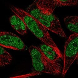 Invitrogen THAP1 Polyclonal Antibody 100 &mu;L; Unconjugated:Antibodies,