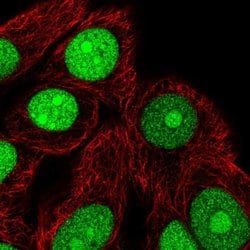 Invitrogen TNPO2 Polyclonal Antibody 100 &mu;L; Unconjugated:Antibodies,