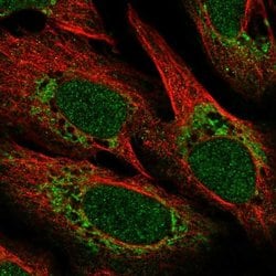 Invitrogen POLD4 Polyclonal Antibody 100 &mu;L; Unconjugated:Antibodies,