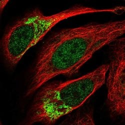 Invitrogen ZNF398 Polyclonal Antibody 100 &mu;L; Unconjugated:Antibodies,