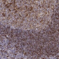 Invitrogen Cyclin F Polyclonal Antibody 100 &mu;L; Unconjugated:Antibodies,