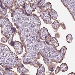 CHST14 Polyclonal Antibody:Antibodies, Polyclonal