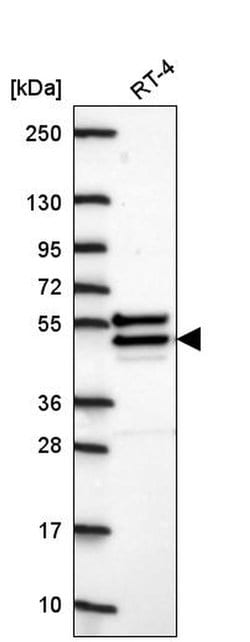CHST14 Polyclonal Antibody:Antibodies, Polyclonal