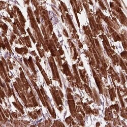 Invitrogen SLC25A5 Polyclonal Antibody 100 &mu;L; Unconjugated:Antibodies,