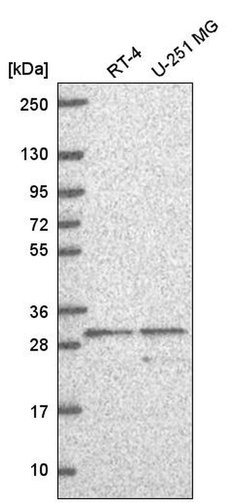 Invitrogen SLC25A5 Polyclonal Antibody 100 &mu;L; Unconjugated:Antibodies,