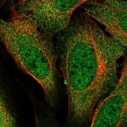 Invitrogen RMP Polyclonal Antibody 100 &mu;L; Unconjugated:Antibodies,