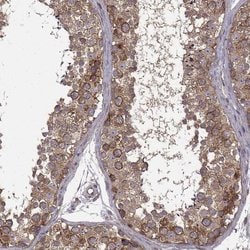 Invitrogen RMP Polyclonal Antibody 100 &mu;L; Unconjugated:Antibodies,