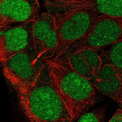 CCDC84 Polyclonal Antibody:Antibodies, Polyclonal