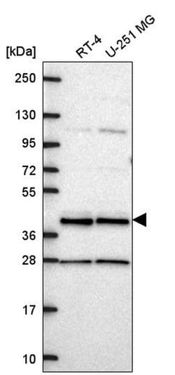 CCDC84 Polyclonal Antibody:Antibodies, Polyclonal