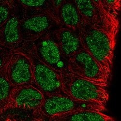 Invitrogen KLF8 Polyclonal Antibody 100 &mu;L; Unconjugated:Antibodies,