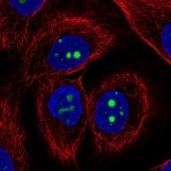 Invitrogen KCNJ14 Polyclonal Antibody 100 &mu;L; Unconjugated:Antibodies,