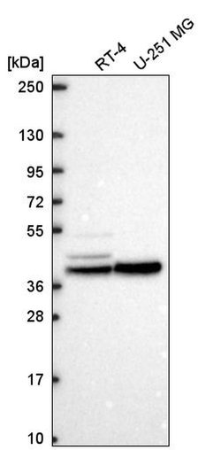 Invitrogen KCNJ14 Polyclonal Antibody 100 &mu;L; Unconjugated:Antibodies,