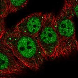 Invitrogen MED26 Polyclonal Antibody 100 &mu;L; Unconjugated:Antibodies,