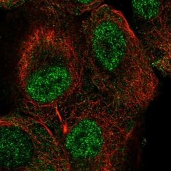 Invitrogen TUT1 Polyclonal Antibody 100 &mu;L; Unconjugated:Antibodies,