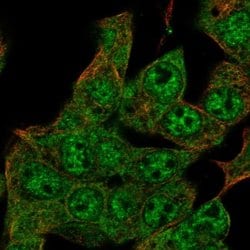 Invitrogen ZIM2 Polyclonal Antibody 100 &mu;L; Unconjugated:Antibodies,